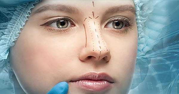 Before Rhinoplasty Operation