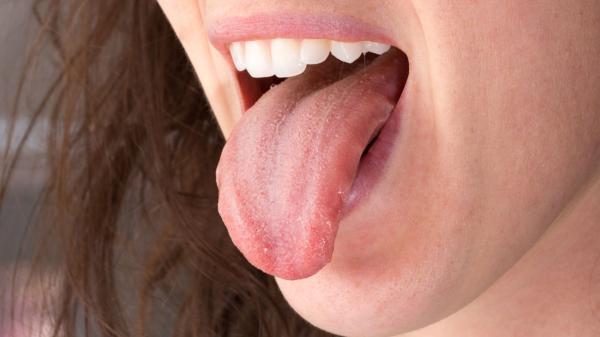 DİL KANSERİ NASIL TEDAVİ EDİLİR?